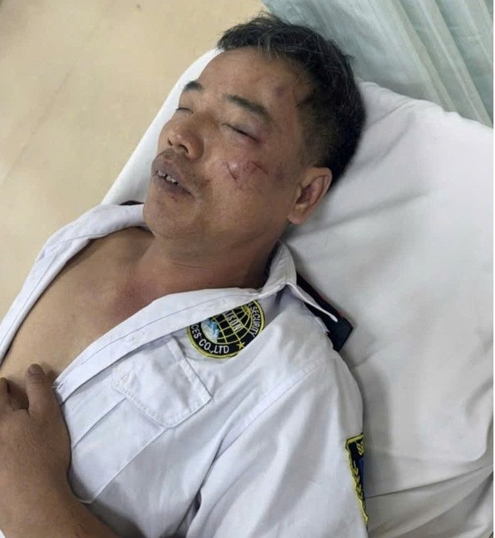 Nạn nhân bị gãy xương sườn và đa chấn thương. (Ảnh: B.L)