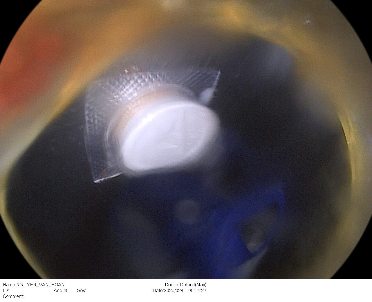 Uống thuốc giảm đau vai gáy, người đàn ông nhập viện gấp vì một sai sót nhiều người Việt mắc phải - Ảnh 1.