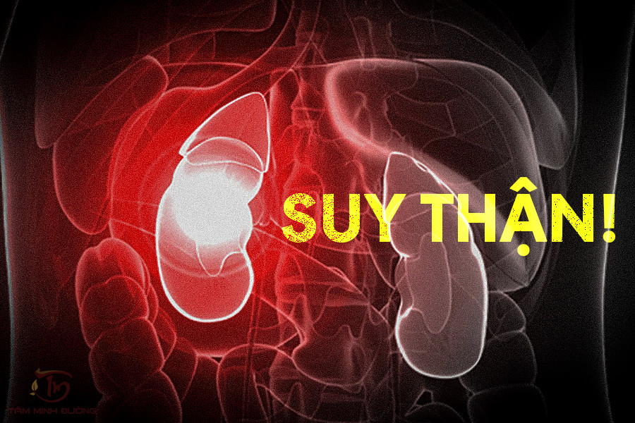 Đang chơi tennis, người đàn ông 53 tuổi phát hiện nguy cơ suy thận từ dấu hiệu nhiều người Việt mắc phải - Ảnh 3.