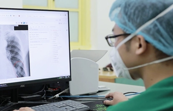 BHXH Việt Nam lên tiếng về thông tin chụp X-quang đủ 6 phút mới được thanh toán插图1