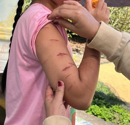 Nữ sinh lớp 5 ở Cà Mau bị người thân dùng dao cắt giấy gây thương tích - Ảnh 1.