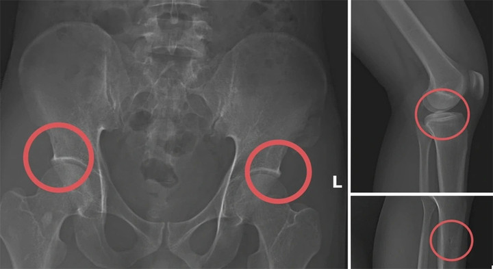 Hình ảnh cho thấy các đối tượng tự gây thương tích nhằm trục lợi.