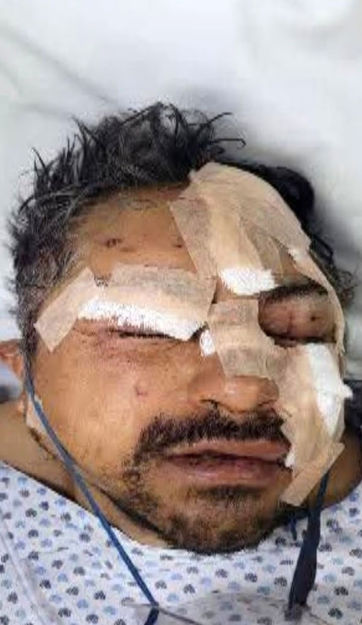 Say rượu thả 6 con sư tử khỏi chuồng, người đàn ông nhận cái kết đau đớn插图1 Người đàn ông bị thương nặng ở tay và mặt. (Ảnh: Jam Press)