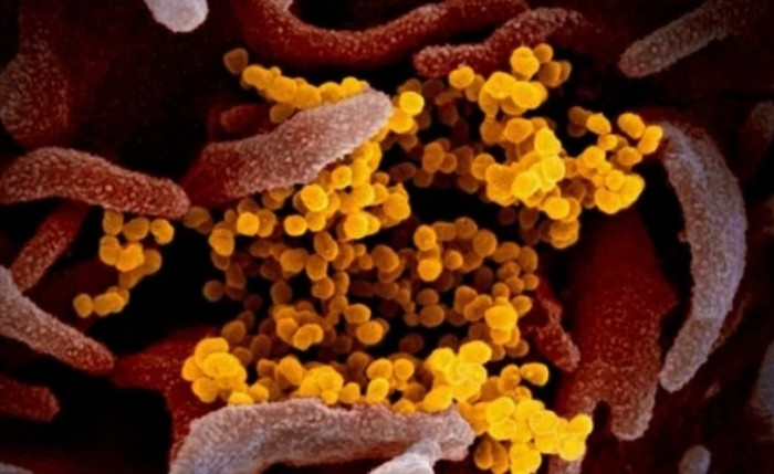 Biến thể COVID-19 mới BA.3.2 đang lan rộng tại Mỹ. (Ảnh: AP)