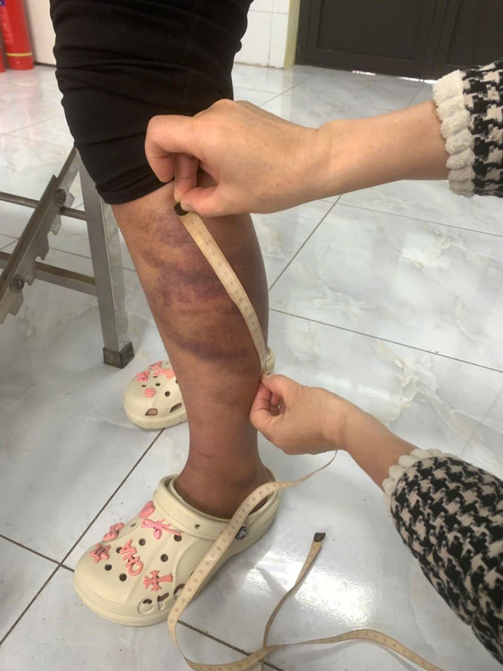 Bắt người đàn ông bạo hành vợ đang mang thai và con 13 tuổi ở Bắc Ninh - 3