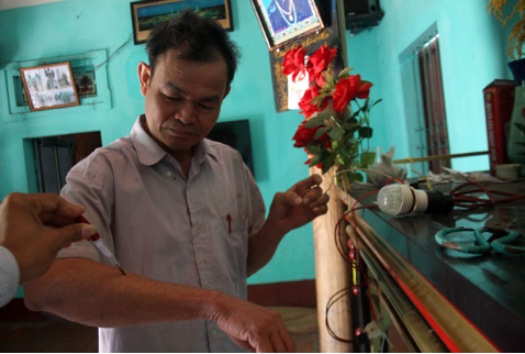 “Dị nhân ngậm điện” gây rúng động: 3 thế hệ miễn nhiễm dòng 220V, biến cơ thể thành dây dẫn - Ảnh 4.