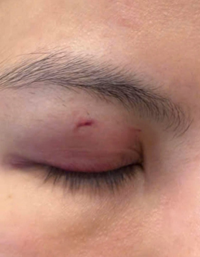 Vết thương của bác sĩ Nguyễn Linh Thùy