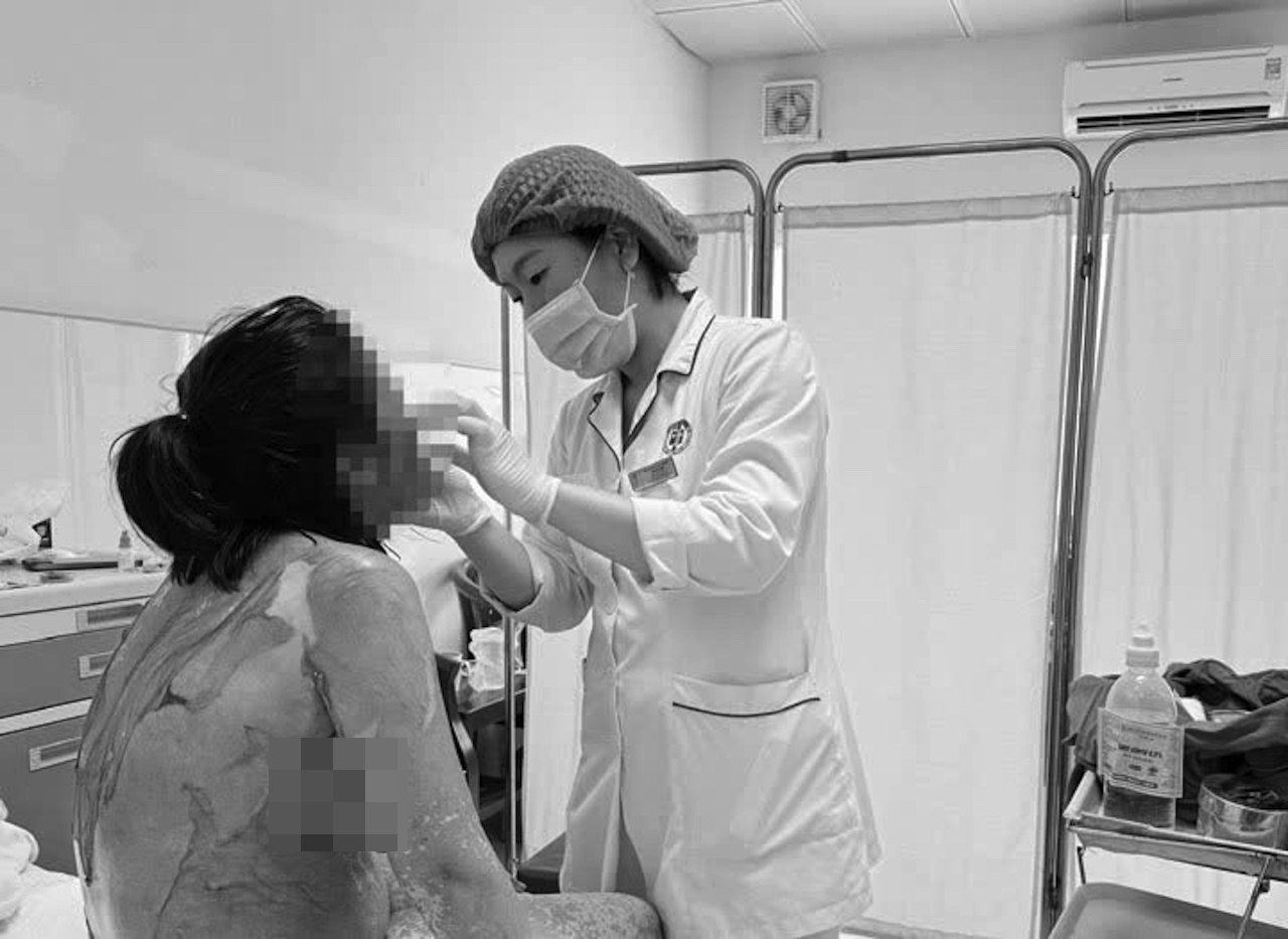 Người phụ nữ Hải Phòng bị tróc da như 'cua lột', lý do tự mua thuốc dị ứng插图1 Wz7751871495780_38df247bf6da8d973bec8825ab241513.png