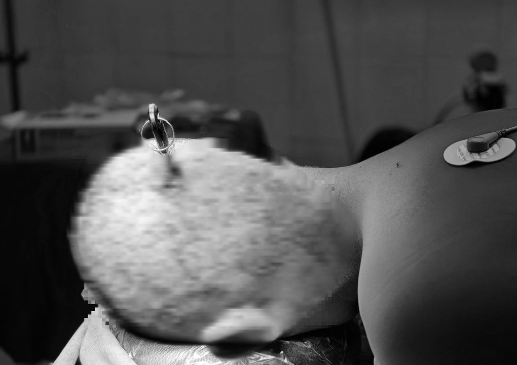 Hai học sinh nhập viện vì tai nạn học đường từ trò đùa nghịch - Ảnh 1.