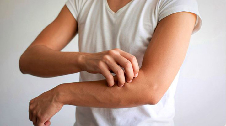 Ngứa đến mất ngủ tưởng dị ứng nhưng cũng là dấu hiệu sớm của suy thận