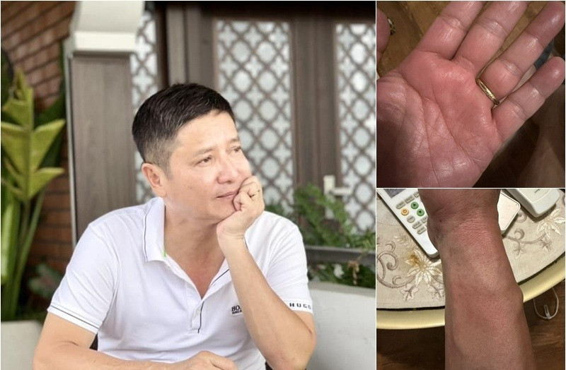 Căn bệnh NSƯT Chí Trung phải chung sống khổ sở suốt nửa năm có thật sự lạ?插图 chitrung2 1200.jpeg
