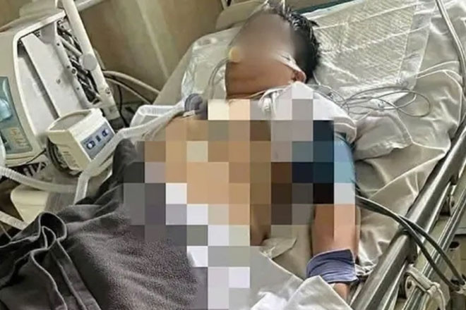 Vụ học sinh lớp 1 nghi bị bạo lực học đường: Chủ tịch UBND phường Đông Hòa nói gì?插图1 Vụ học sinh lớp 1 nghi bị bạo lực học đường: Chủ tịch UBND phường Đông Hòa nói gì?插图1