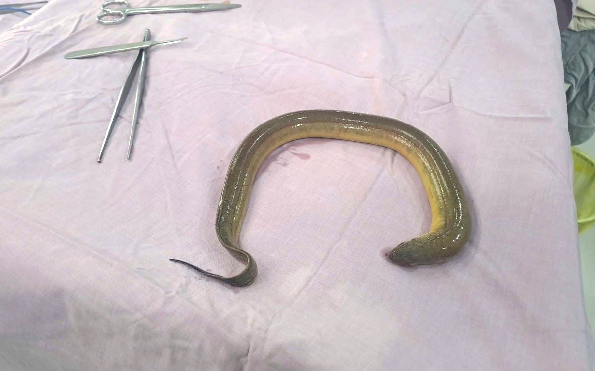 luon trong o bung.jpg
