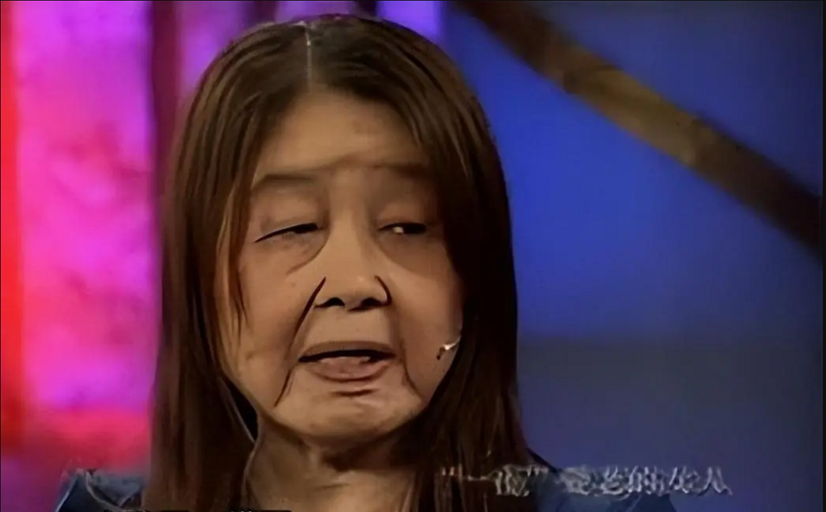 Cô gái 28 tuổi bỗng già đi nhanh chóng, họ hàng tưởng