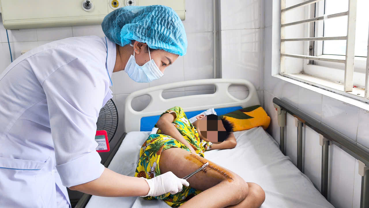 Sốt cao, đau chân, bé trai 11 tuổi suýt tàn phế vì tụ cầu vàng - Ảnh 1.