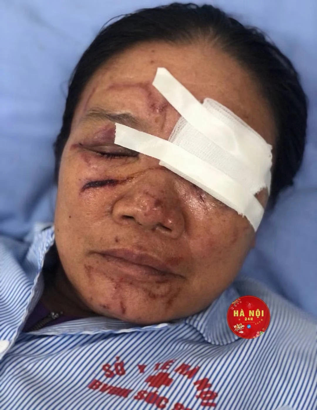 vu ba ban rau bi xit nuoc chay mau mat co quan chuc nang phu tho vao cuoc hinh anh 2