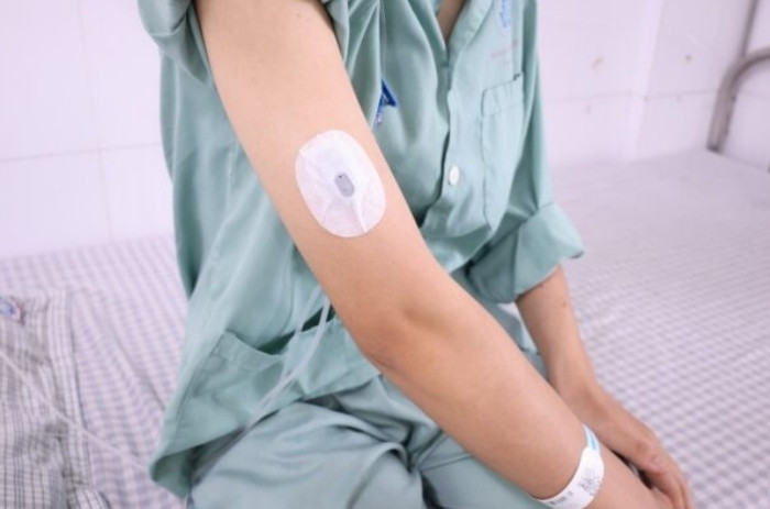 Người bệnh được theo dõi đường huyết bằng thiết bị CGM. (Ảnh: BVCC)