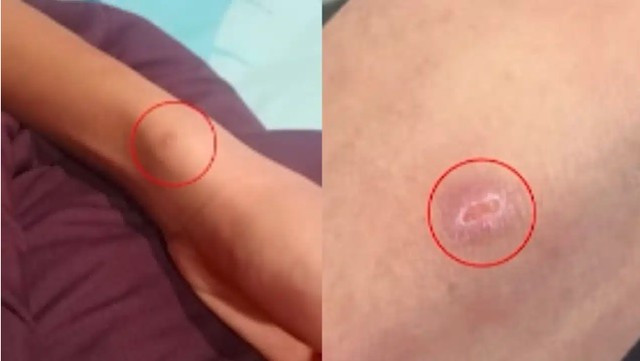 Thấy con trai người đầy vết thương, bố mẹ chết lặng khi nghe em kể chuyện đau lòng xảy ra suốt 2 năm ở trường插图 1-1786605232.jpg