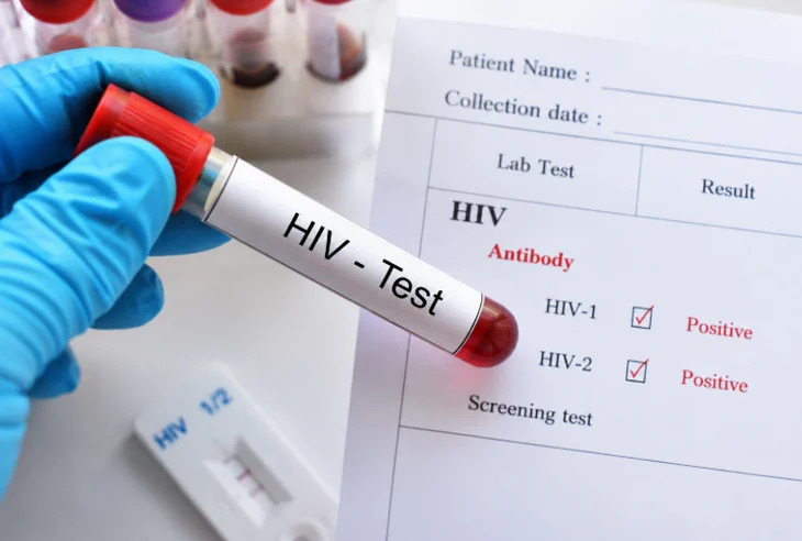 co-gai-29-tuoi-sup-do-khi-cam-ket-qua-duong-tinh-hiv-chi-tiet-dem-dinh-menh-khien-nguoi-me-app-hen-ho-toat-mo-hoi-hot-dpsl-2-1788494511.png